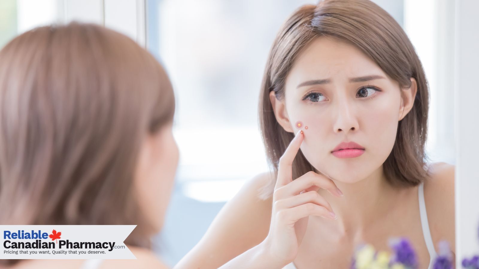 A girl applying cream for treating pimples on her face.